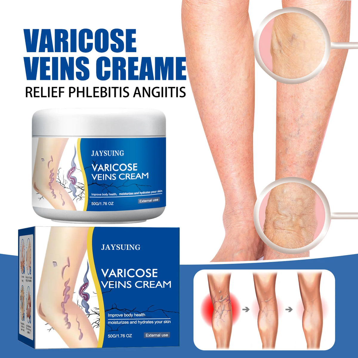 Leg Vein Repair Cream Varicose Massage Earthworm Legs