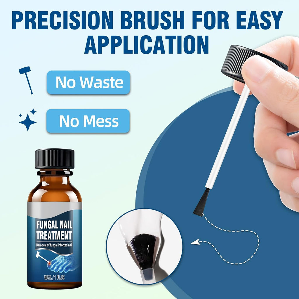 Extra Strength Toenail Fungus Treatment – Nail Repair Solution to Restore Damaged, Discolored, and Brittle Nails with Fast-Acting Natural Formula for Healthy Growth, 30Ml